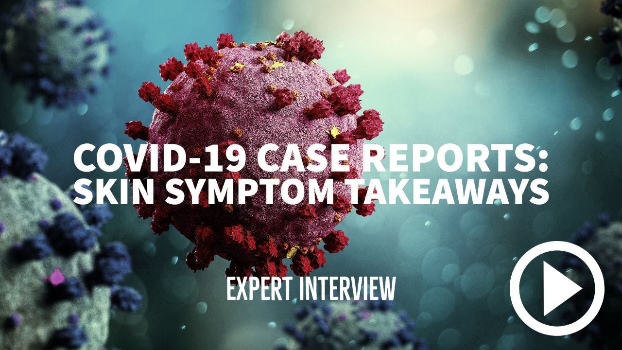illustration of COVID-19 with writing "COVID-19 case reports: skin symptom takeaways - Expert interview"