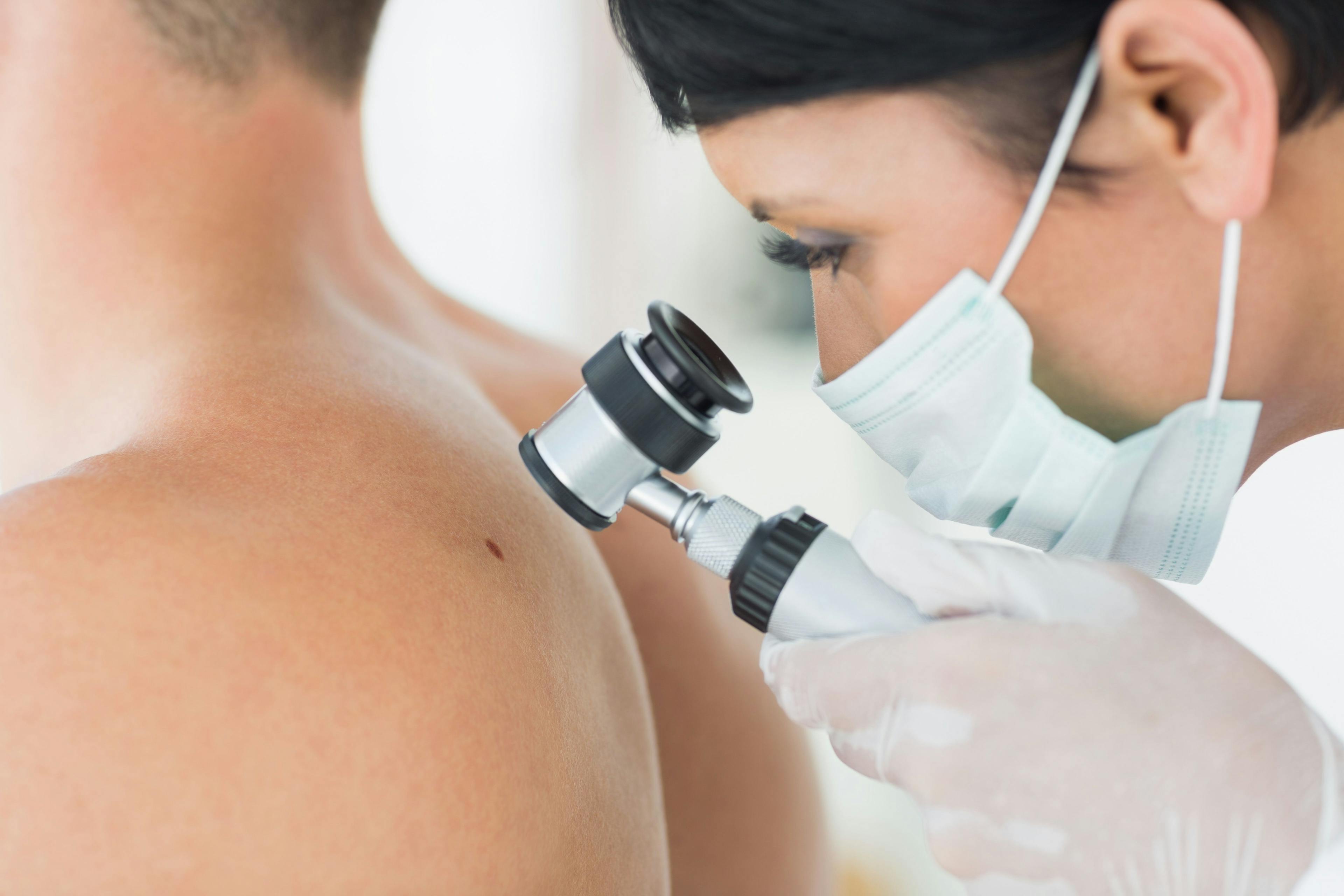 Patient Age Impacts Satisfaction with Physician-Provided Melanoma Information