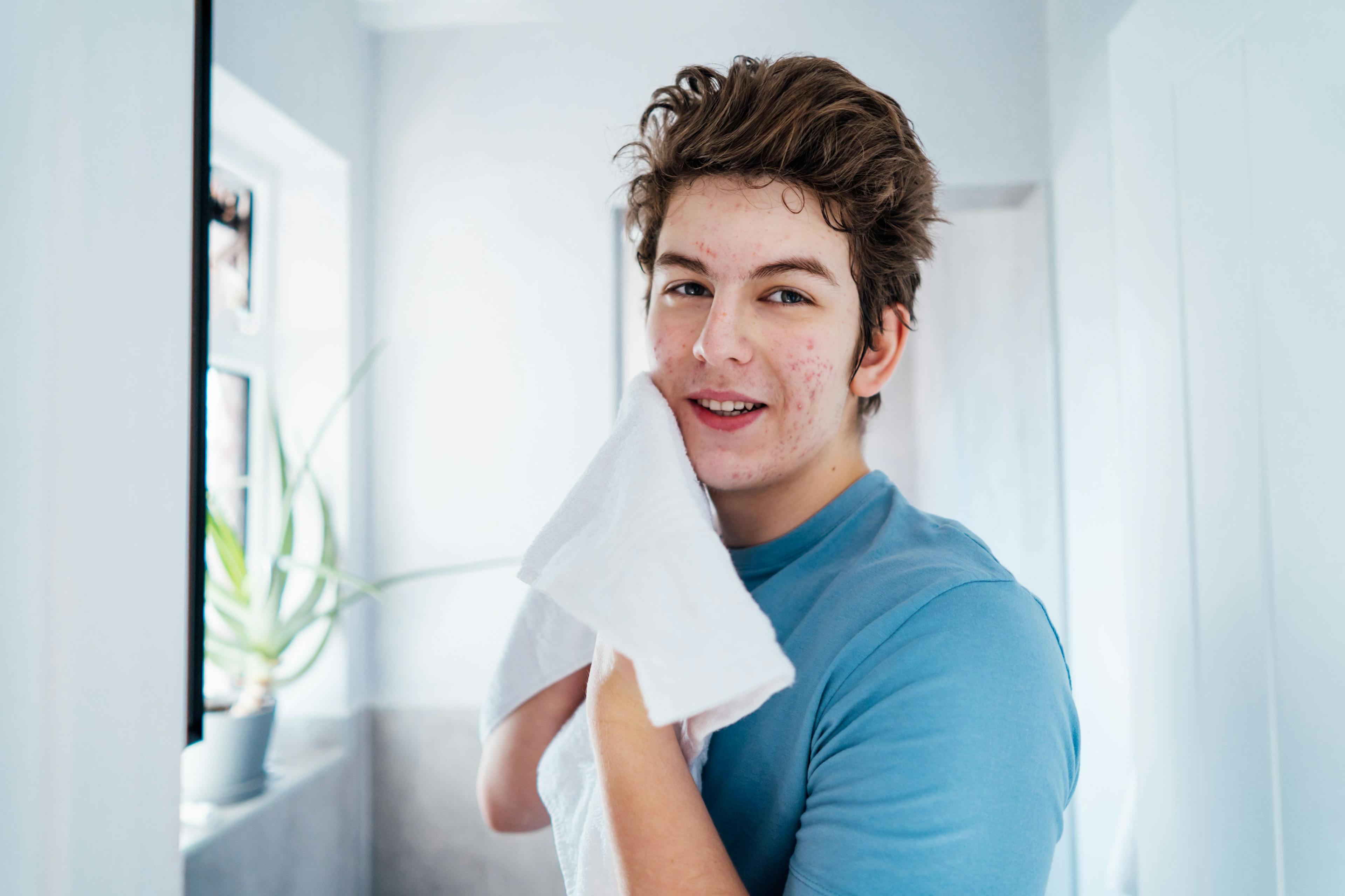 Teenage boy with acne utilizes a skin care routine | Image Credit: okrasiuk - Adobe Stock