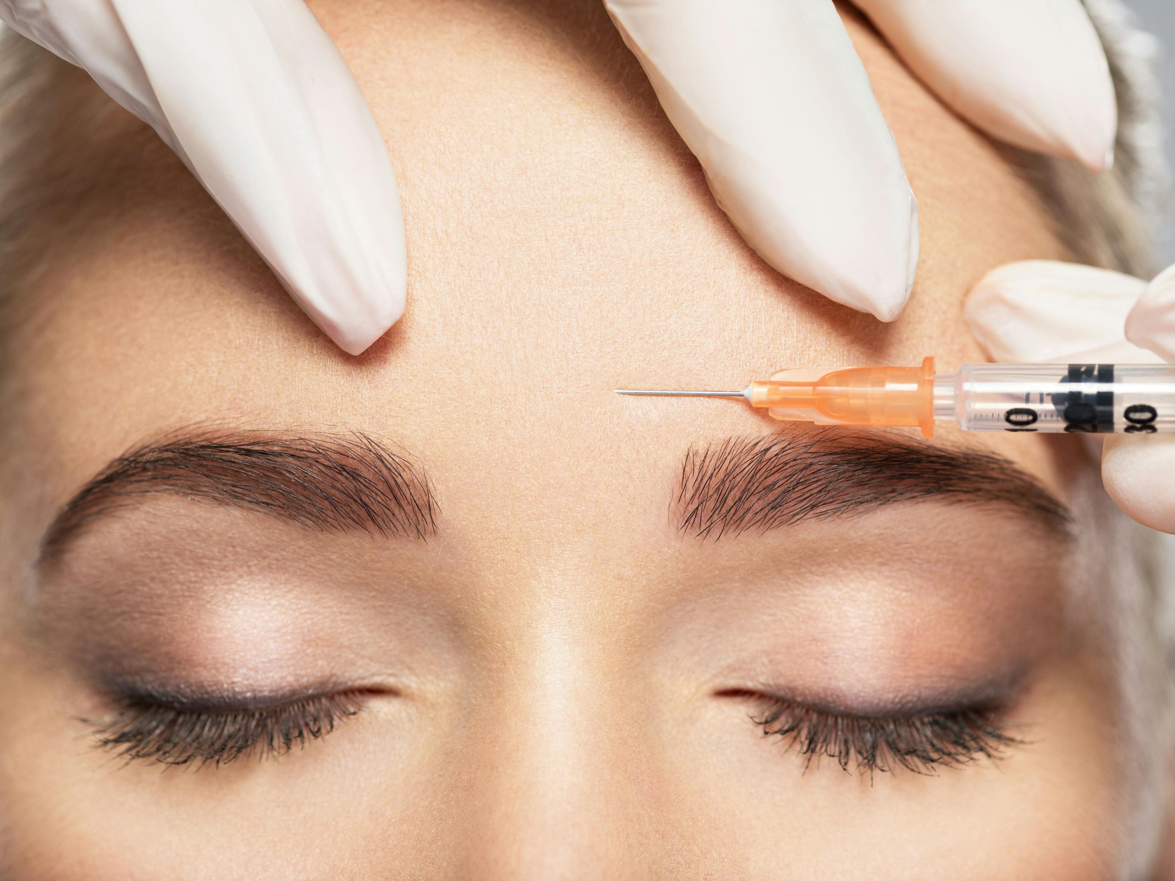Botulinum Toxin Type A Unparallel Improvements to Skin Quality