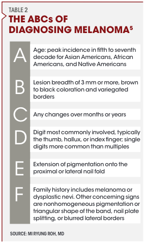 Table 2: The ABCs of Diagnosing Melanoma