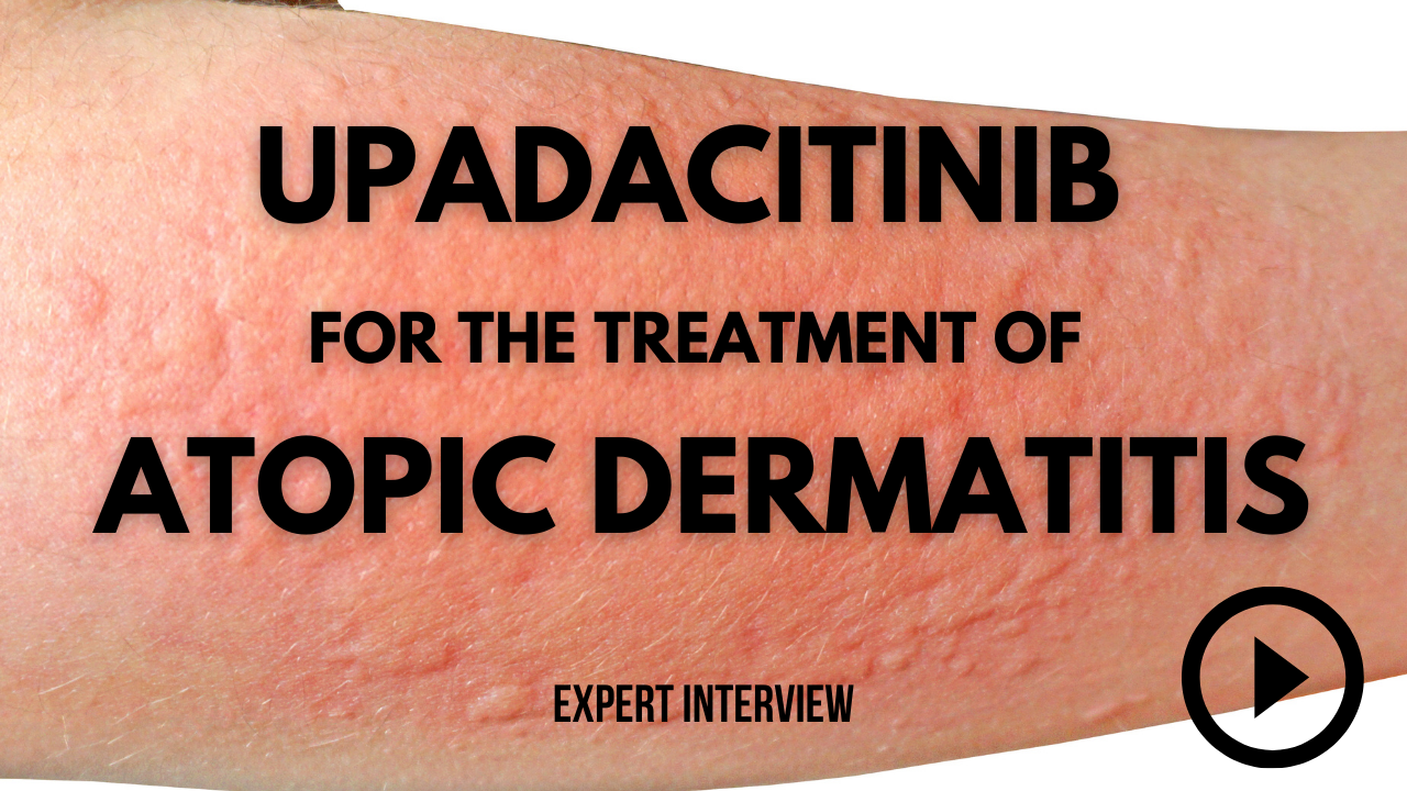 Upadacitinib for the Treatment of Atopic Dermatitis